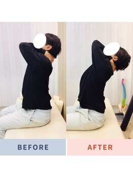 ナオル整体 三鷹院(NAORU整体)/20代男性施術事例【胸椎伸展】