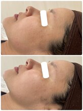 ムー(mu)/ララピール/トーンアップ/潤い