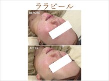 ティアム バイ テトテ 神戸三宮(TIAM by tetote)/ララピール