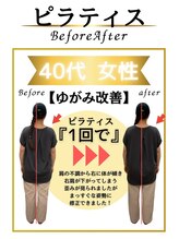 みなもと整骨院/40代　姿勢改善で歪み解消
