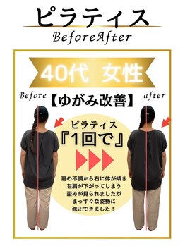 みなもと整骨院/40代　姿勢改善で歪み解消