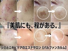 パルファンカルム 駅西本町店/合言葉。美肌にも、ほどがある。