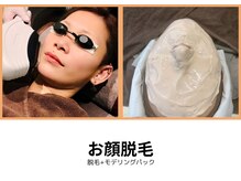 シェリール(Cherir)/お顔脱毛