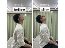 大館整体スタジオ/施術ビフォーアフター