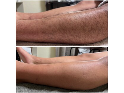 ルアナ(Luana)の写真