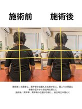 シトラスほぐし家整体院/施術