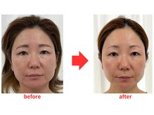 ブプラ 小倉店(BUPURA)/