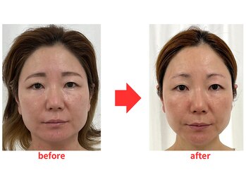 ブプラ 小倉店(BUPURA)/