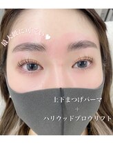 アンナボーテ(Anna beate)/お顔のアップグレード