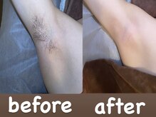 ソーレエルーナ(SOLE e LUNA)/ワキ脱毛 ワックス脱毛