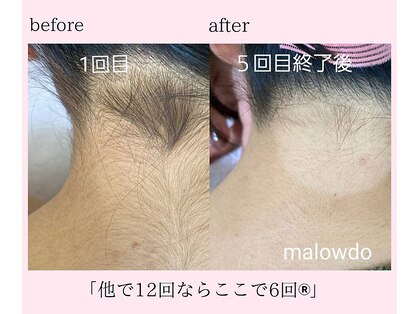 マロウド(malowdo)の写真