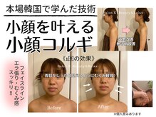 サロン ケイ(Salon K)/小顔/美背中には韓国骨気/コルギ