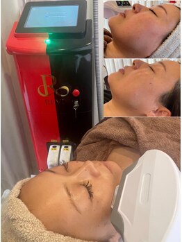 サンメリア(Sunmeria)/REVI《光フェイシャル》