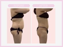 スリムライン 弘前店(The Slim Line)/before→after