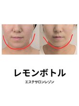 レゾン 京橋店/[レモンボトル]ビフォーアフター