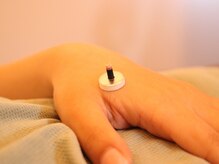 鍼灸整体ととのう 別府本院/