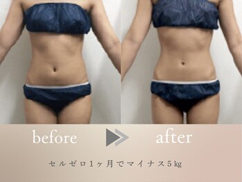 グロッシー(glossy)/【症例】理想のボディラインに