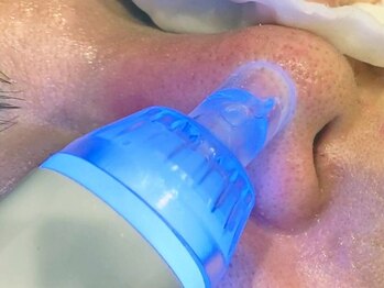 ミックスアップ 池袋店(Mix up!!)の写真/【64％OFF★水光肌フェイシャル】ヒト幹細胞たっぷり導入でハリ・ツヤ復活!潤艶×弾力★褒められ水光肌へ!!