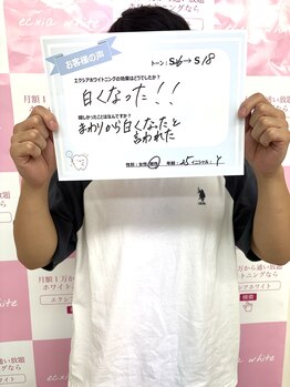 ルアナシンフォニア エクシア 東銀座店(Luana-Sinfonia)/ホワイトニングビフォーアフター