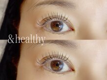 ユーロ(EURO)/アンドヘルシー