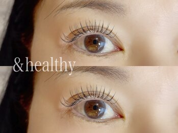 ユーロ(EURO)/アンドヘルシー