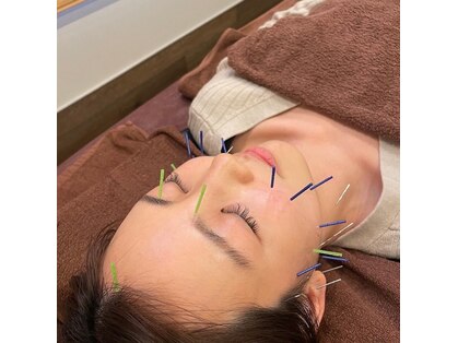 長寿鍼灸院 長寿整骨院の写真