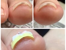ブルーネイル(Blue Nail)の雰囲気（巻き爪にお悩みの方に！韓国発の最先端ジェラで整える巻き爪ケア）