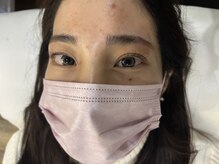 ジョリー(Jolie)/