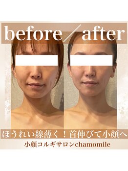 カモミール(chamomile)/BeforeAfter