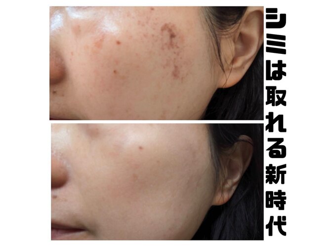 ビセラ(Vicella)｜ホットペッパービューティー 