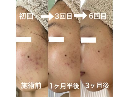 シェノンの写真