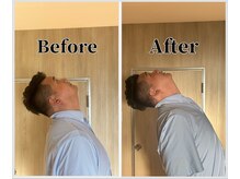 整体ラルース 中目黒(LALUZ)/30代 男性 ストレートネック改善