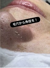 スパークル/毛穴ケア/角栓/詰まり