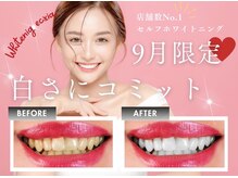 エクシア ホワイトニング 富山店