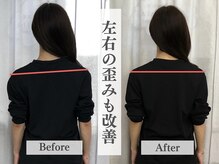 アライメントトウキョウ 麻布十番(Alignment TOKYO)/身体の左右差改善☆