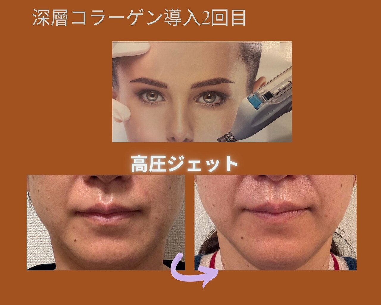 エステサロン プラスエー(+A)｜ホットペッパービューティー