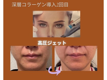 エステサロン プラスエー(+A)の写真