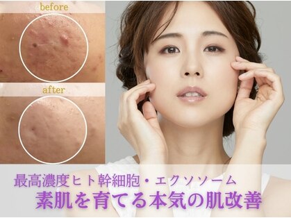 ディサイドロー(DECIDE L.A.W)の写真