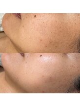 ルアラナ(Lualana)/約4ヶ月の変化