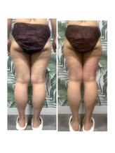 バイブスプラス(Vibes+)/