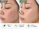 ライム 柏(LIME)の写真