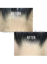 ファウラ(faura:)/襟足脱毛