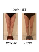 ファミーユ 新宿店/【太ももケア】90分