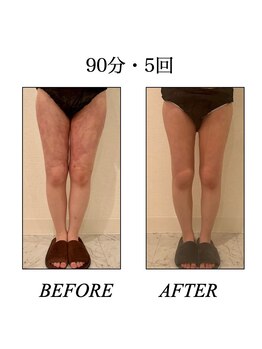 ファミーユ 新宿店/【太ももケア】90分