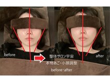 整体サロン宇宙/☆本格あご・小顔矯正☆