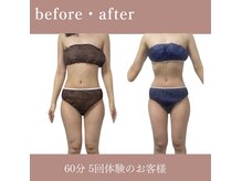ソウ(SOU)の雰囲気（セルライトゼロでお腹周り痩身もお任せ！究極ボディへダイエット）