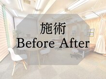 ナオル整体 札幌院(NAORU整体)/札幌円山/整体/姿勢矯正/O脚