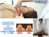 美容鍼×美容整体【ほうれい線】気になり始めたら美容鍼！11,000→初回9,900