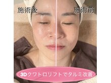 フラン(franc)の雰囲気（タルミやムクミもスッキリ☆目の疲れにも効果的です。）
