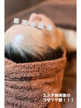 エンチャント(ENCHANT+)/韓国肌管理が人気です！